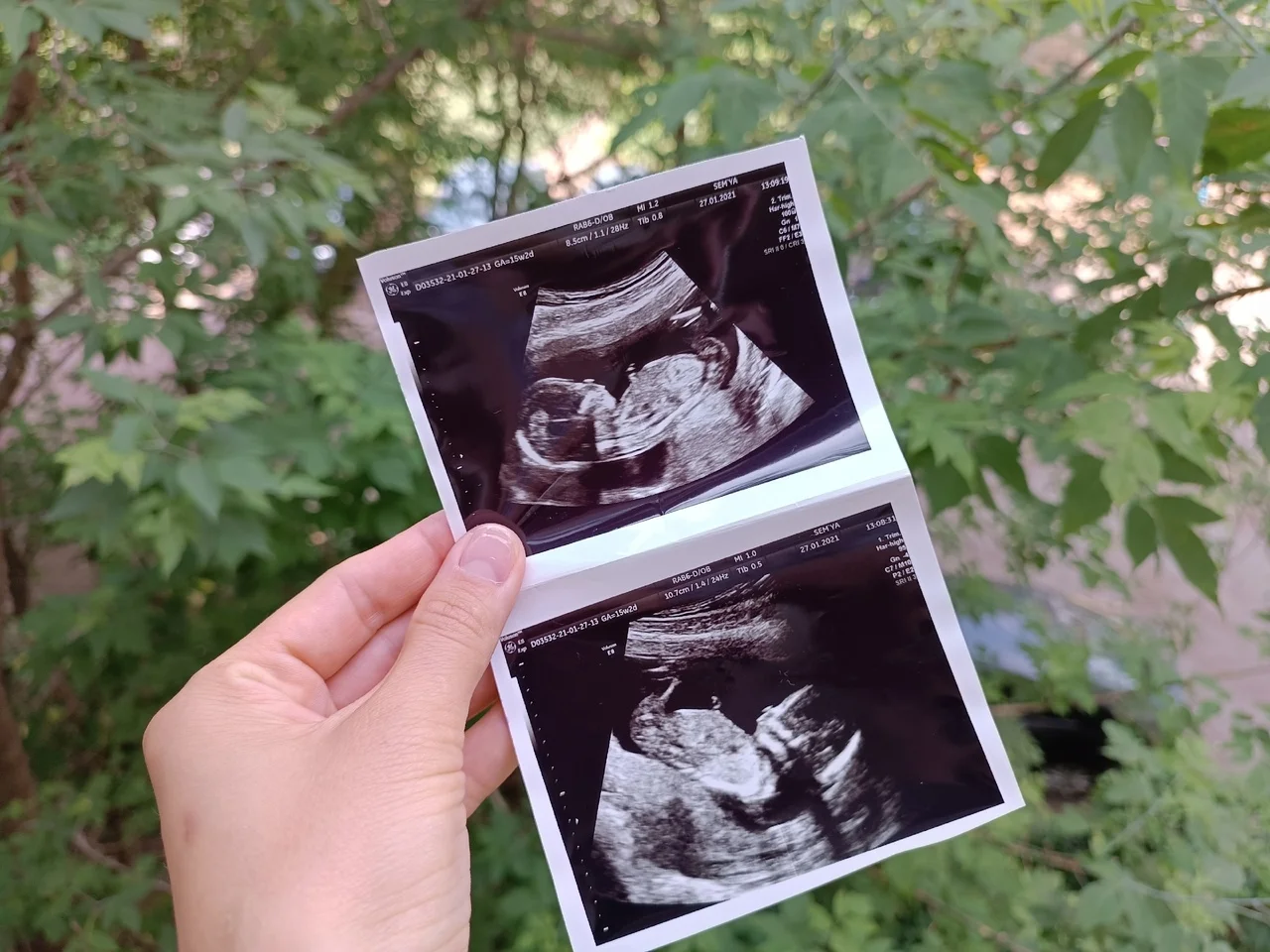 Уфимский гинеколог назвала идеальный возраст для зачатия ребенка